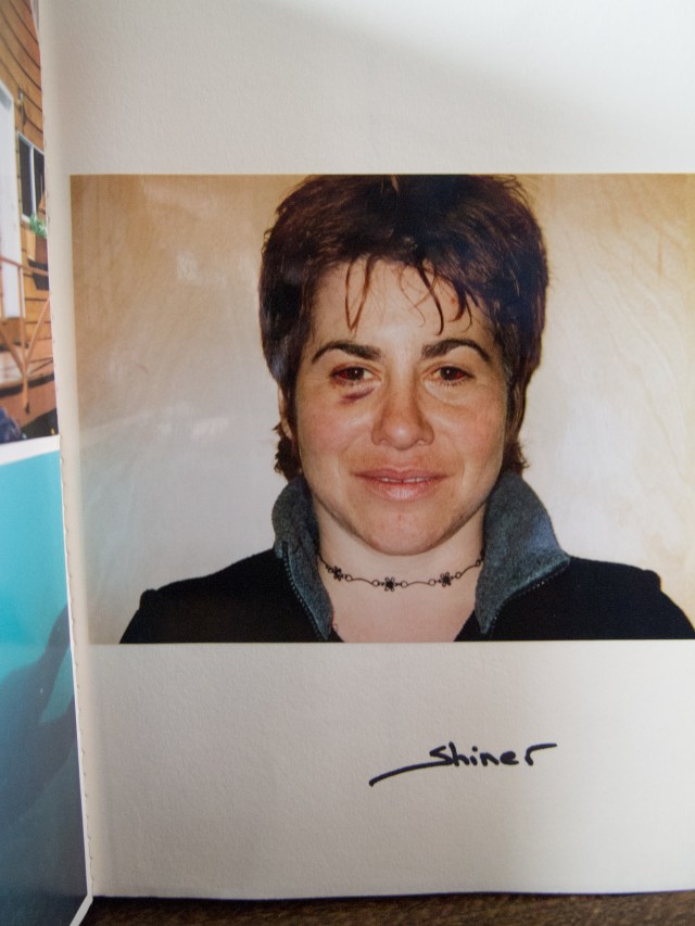 Shiner . . . Image in my first dive log. Me just after my 37th birthday with "mask squeeze". 